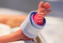 Human Milk-based Nutrition for premature babies