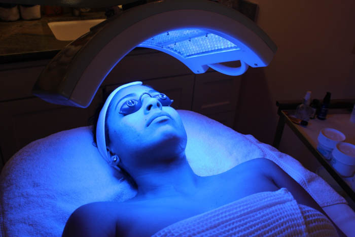 Blue Light Therapy for Acne