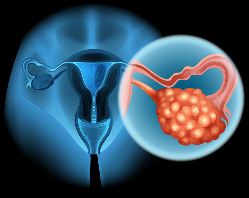 gynaecological cancers myths and facts