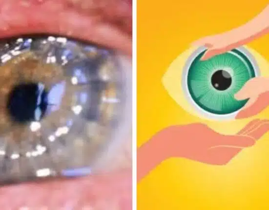 Remarkable achievement: Successful Eye Donation from the Ramban district