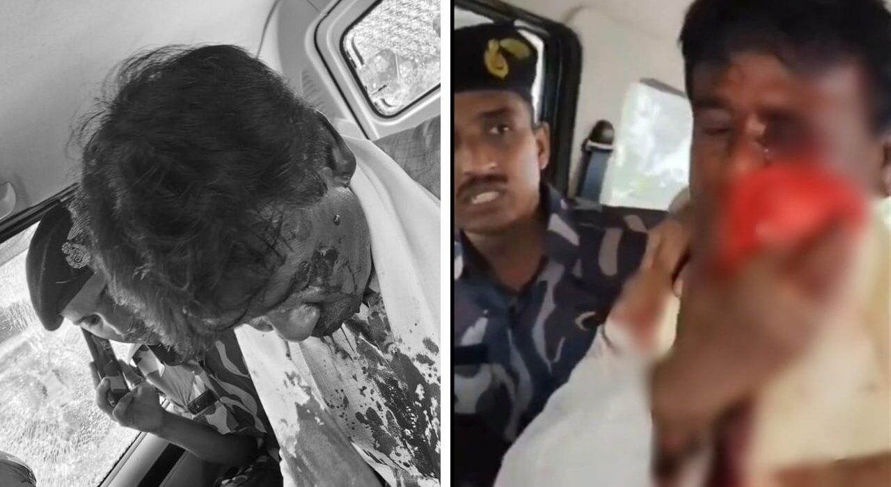 BJP MP Khagen Murmu Injured in Stone-Pelting Attack During North Bengal Floods