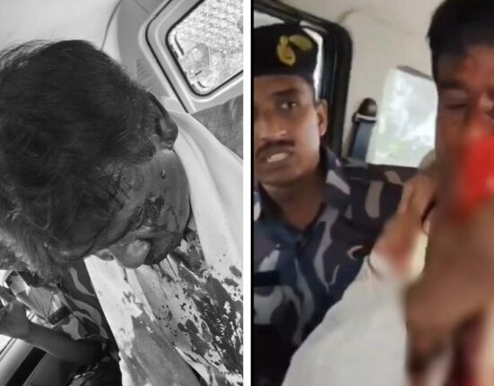 BJP MP Khagen Murmu Injured in Stone-Pelting Attack During North Bengal Floods