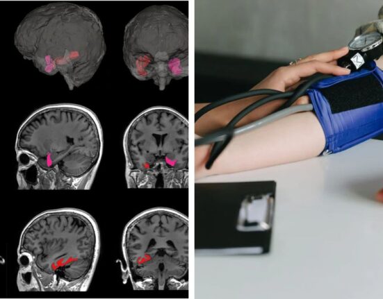 Rapid BP Fluctuations in Elders Signals Risk of Brain Shrinkage