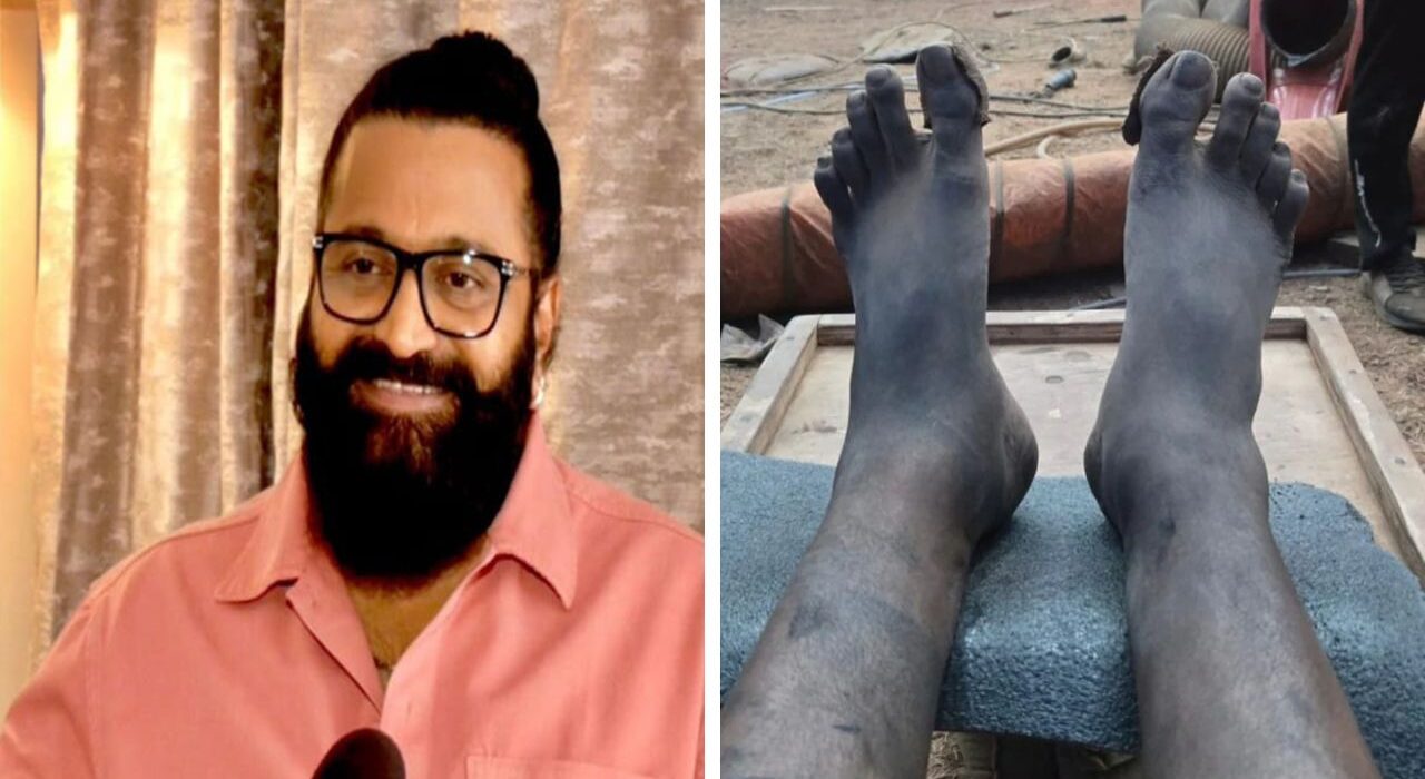 Rishab Shetty Shoots Kantara Chapter 1 Climax with Swollen Leg and Exhaustion
