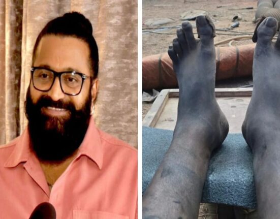 Rishab Shetty Shoots Kantara Chapter 1 Climax with Swollen Leg and Exhaustion