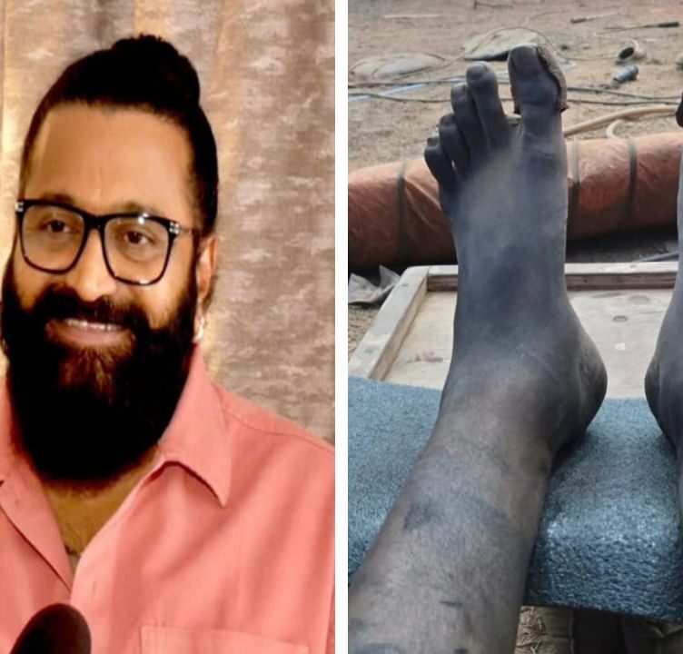 Rishab Shetty Shoots Kantara Chapter 1 Climax with Swollen Leg and Exhaustion