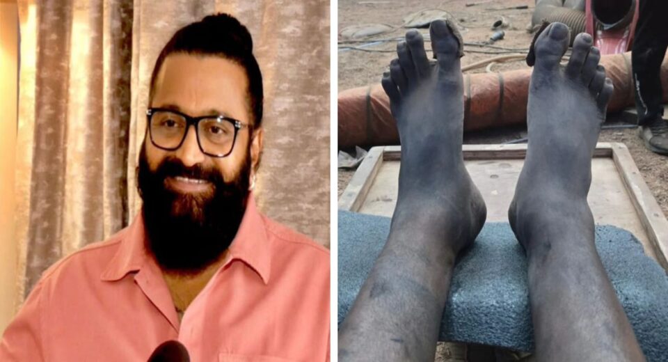 Rishab Shetty Shoots Kantara Chapter 1 Climax with Swollen Leg and Exhaustion