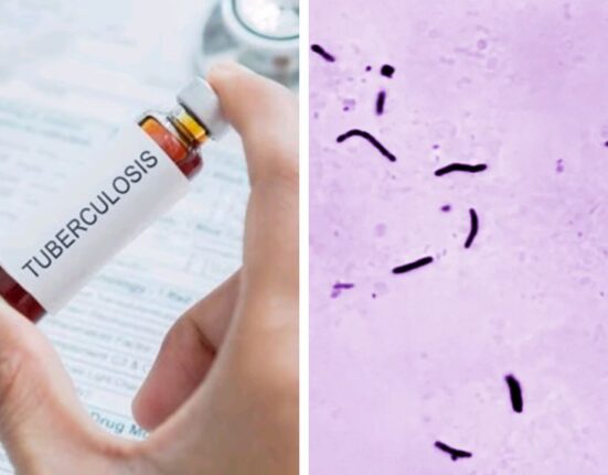 WHO: TB Cases and Deaths Decline in 2024 Amid Funding Shortfalls