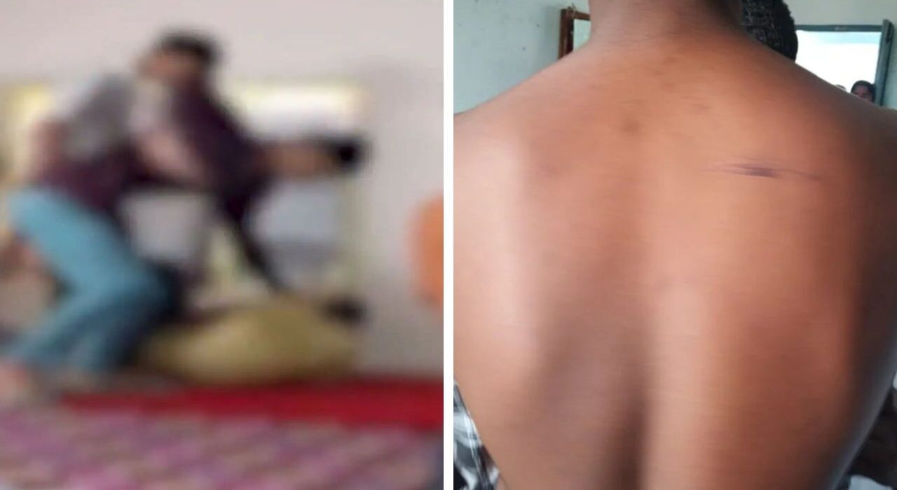 Ragging and Assault in Telangana: Seniors Beaten Class 10 Student With Sticks in Hostel Room