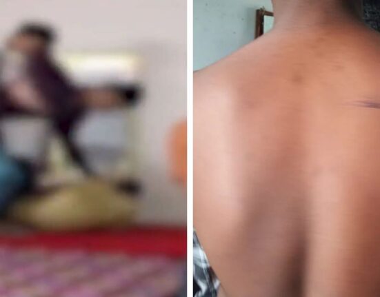 Ragging and Assault in Telangana: Seniors Beaten Class 10 Student With Sticks in Hostel Room