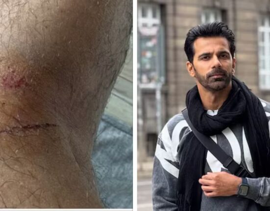 ‘Mental Trauma’: Anuj Sachdeva Speaks After Parking Attack, Reveals Injury Marks