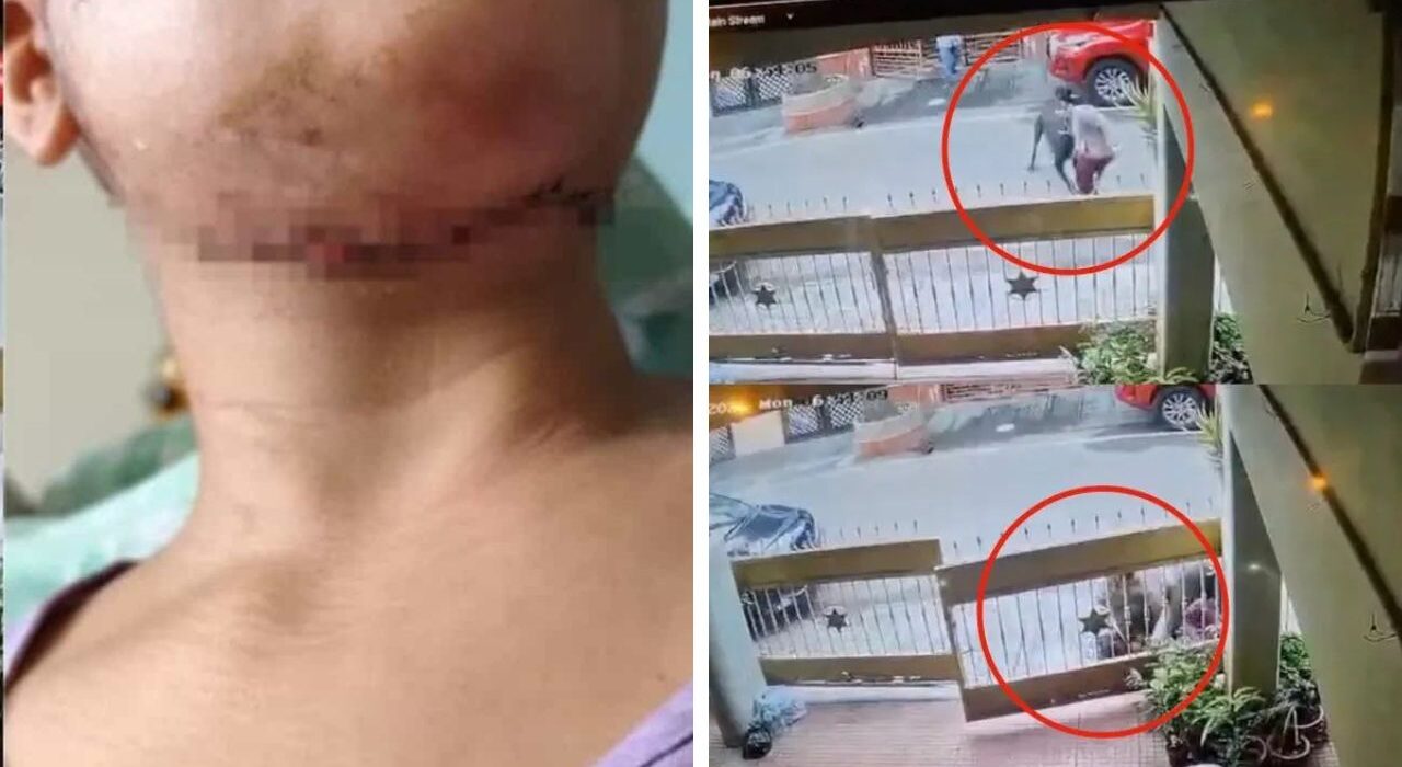 Bengaluru Pet dog attacks on women, Bites face and neck, get 50 Stitches on Body