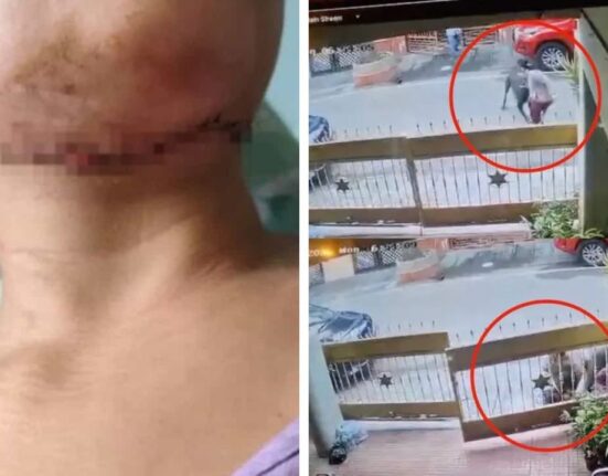 Bengaluru Pet dog attacks on women, Bites face and neck, get 50 Stitches on Body