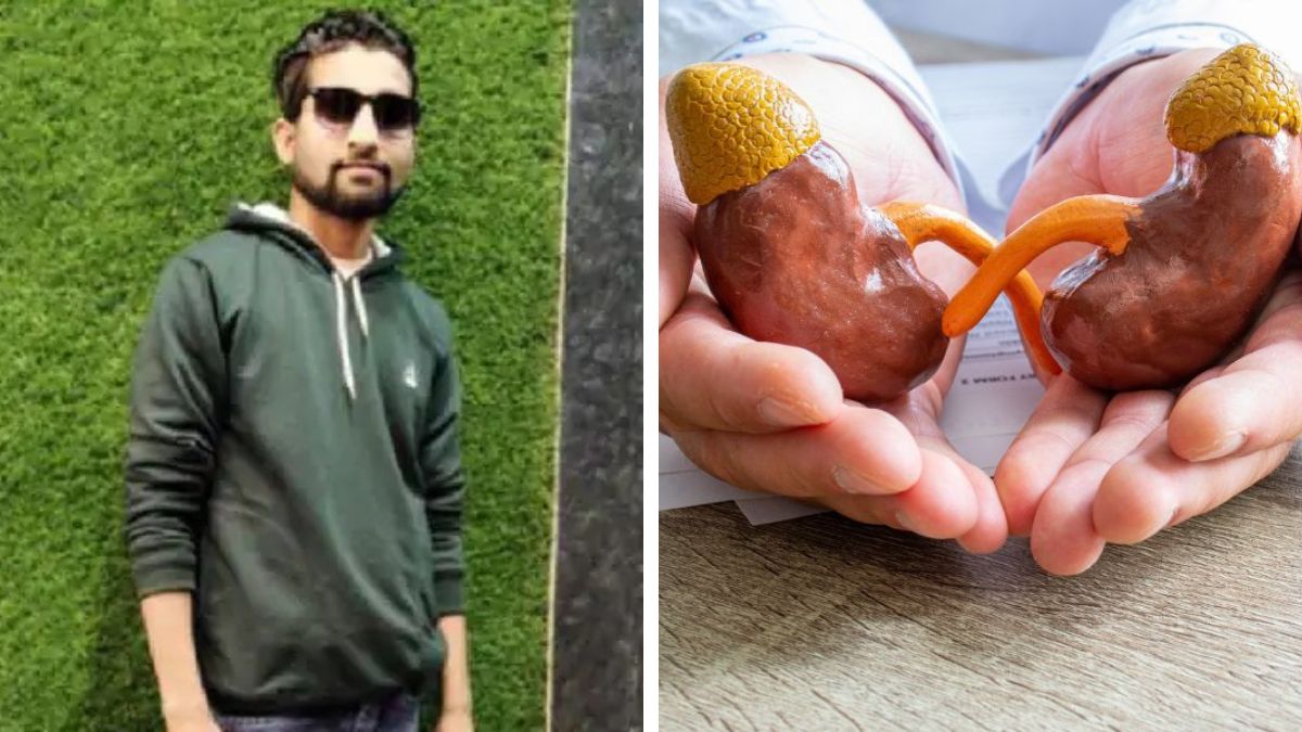 Child admitted for kidney stones in Satna, Madhya Pradesh allegedly loses both kidneys due to doctor's negligence