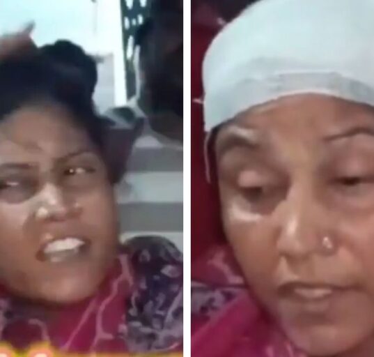 TMC worker with fake bandage on her head exposed on Live TV