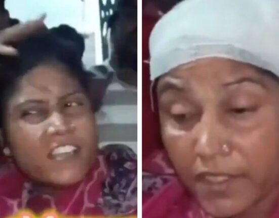 TMC worker with fake bandage on her head exposed on Live TV