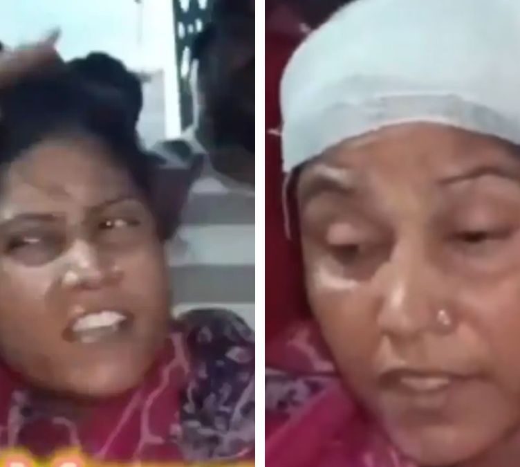 TMC worker with fake bandage on her head exposed on Live TV